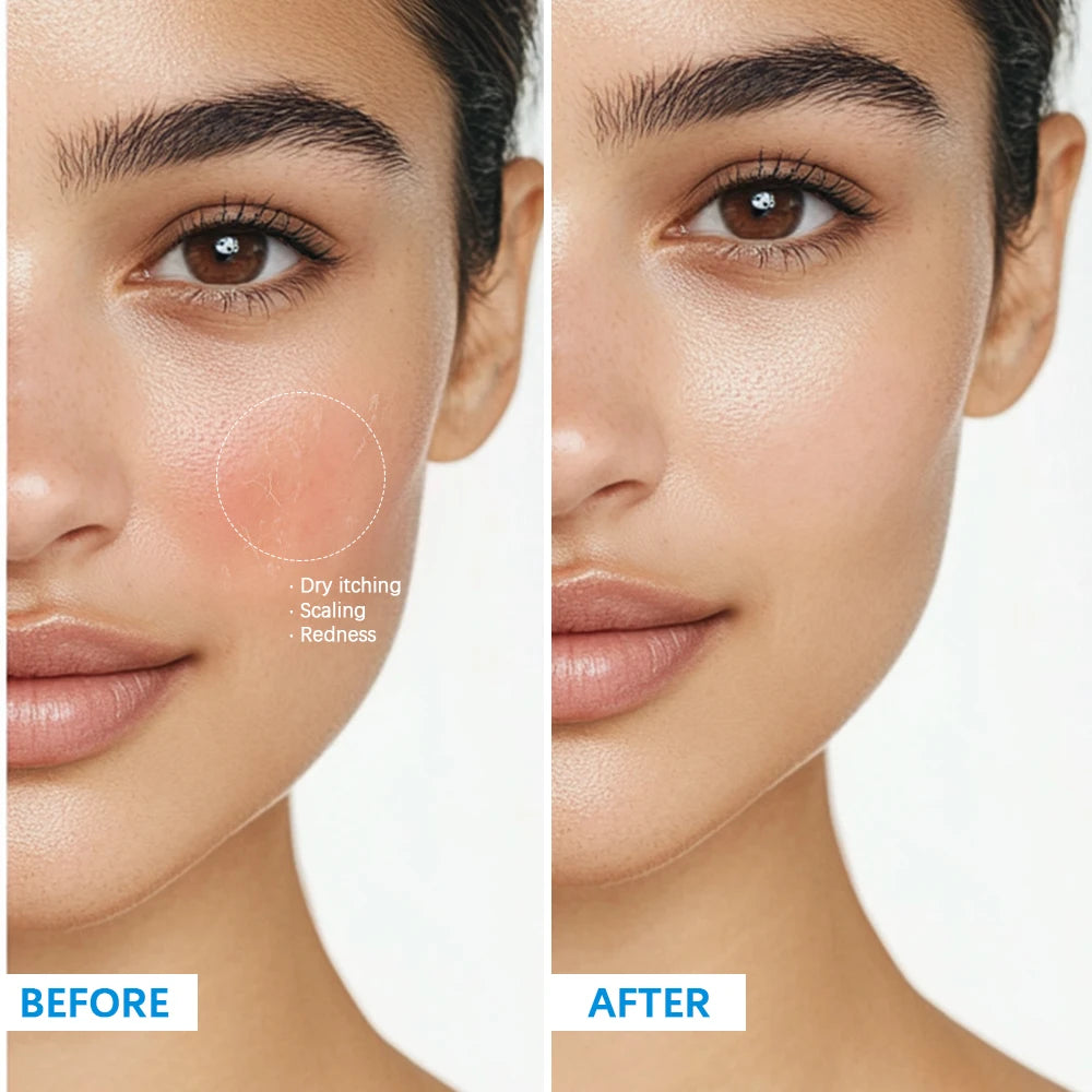 Soothing Multi-Purpose Hydrating Cream Reduces Redness Daily Helps Relieve Rough Cracked Skin Deep Skin Care